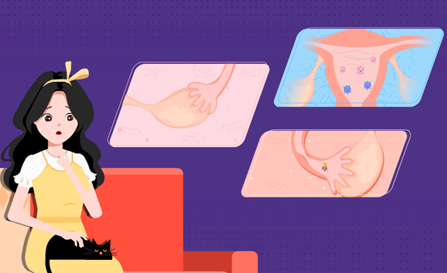 孕妇产前忧郁症思考问题MG动画视频模板素材