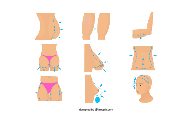 整容手术不同部位规划划线卡通风格