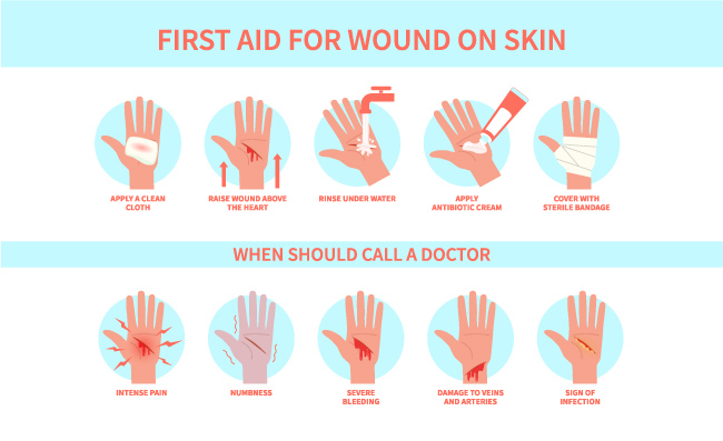 手部皮肤伤口处理受伤出血割伤的手部紧急治疗医学指南矢量信息图表