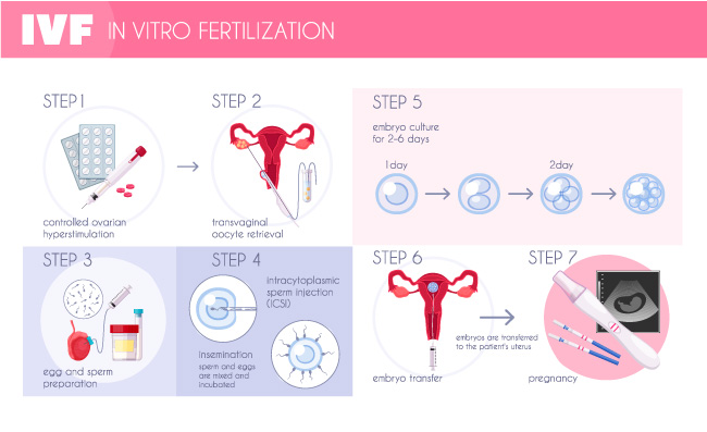 受孕备孕体外受精IVF图表与怀孕进度矢量图的步骤图片