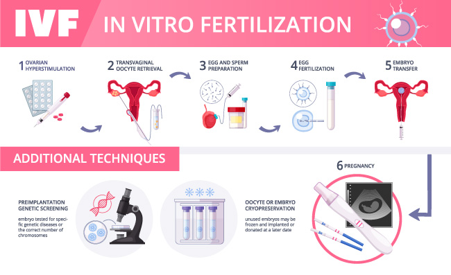 体外受精IVF平面图表备孕技术步骤矢量图早孕试纸