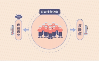 太阳暴晒皮肤病变科普动